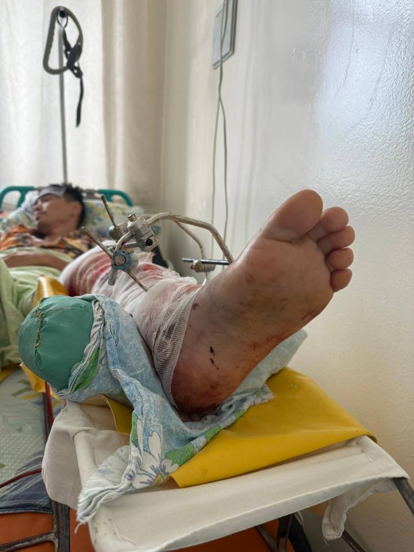 Сотрудника завода «СарыаркаАвтоПром», на которого наехал погрузчик, перевели в больницу Астаны